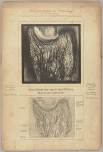 Pulpa aus der Krone eines menschlichen oberen Molaren von Dr. Alfred Gysi