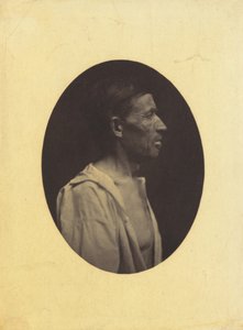 Ein Porträt, im Profil gesehen, eines 42-jährigen Mannes, betäubt durch Alkoholmissbrauch..., 1854-1856 von Duchenne de Boulogne