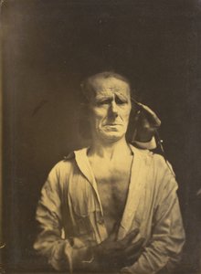 Krampf des m. corrugator supercilii unter sehr starkem Licht links, Ein entspanntes Gesicht..., 1854-1855 von Duchenne de Boulogne