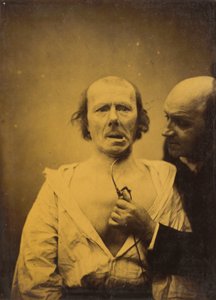 Diese Kontraktion des M. platysma allein fehlt Ausdruck, 1854-1856, gedruckt 1862 von Duchenne de Boulogne