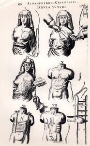 Operation bei Brustkrebs, aus Armamentarii Chirurgici von Johannes Schultes, veröffentlicht in Amsterdam, 1672