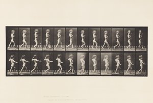 Tafel 540. A, O-Beine; Junge; B, Wirbelsäulenverkrümmung; Mädchen geht, 1885