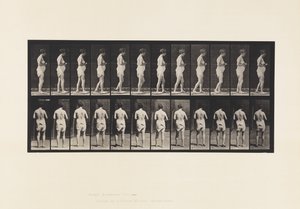 Tafel 542. Multiple Zerebrospinale Sklerose - Gehen