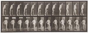 Tafel 547. Hemiplegie; Gehen mit Krücke
