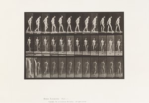 Tafel 559. Verbreitete Sklerose; Gehen mit Stock