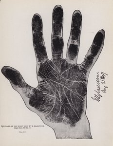 Die Hand des ehrenwerten W. E. Gladstone