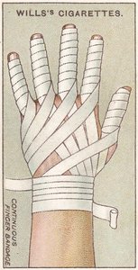 Durchgehender Fingerverband, Nr. 48 aus der Erste-Hilfe-Serie von Willss Zigarettenkarten, 1913