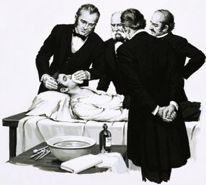 Dr. Crawford Long macht einen Studenten bewusstlos, bevor er eine Operation durchführt von English School