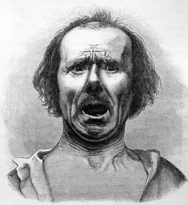 Horror und Agonie, kopiert von einem Foto von Dr. Duchenne, Illustration aus 