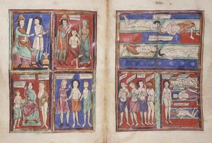 Sloane 1975 fol.91v-92 Medizinische Szenen von English School