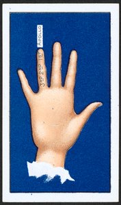 Dritter Finger