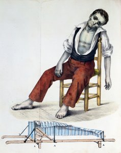 Cholera Morbus, aus Relacao, Historica, Statistica e Medica da Cholera-Morbus von Francisco d