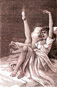 Hysterie, ein extrem mentales Phänomen, Psychosen und Psychoneurosen. 1887 (Gravur) von French School