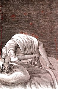 Hysterie, geistige und nervöse Störung, verursacht durch intensive Angst. 1887 von French School