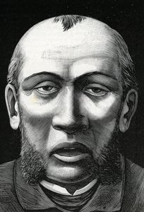 Patient mit Gehirnerweichung (Gravur) 1888 von French School
