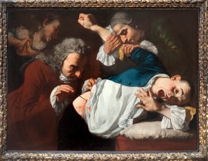 Die Operation, 1753-54