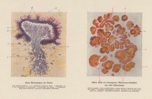 Actinomyces bovis von German School