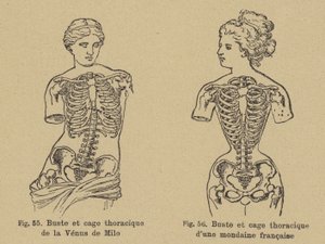 Vergleich der Brust- und Rippenform der Venus von Milo mit der einer französischen Gesellschaftsdame des späten 19. Jahrhunderts von German School