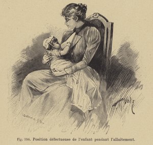 Falsche Position eines Babys beim Stillen von German School