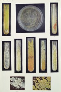 Syphilus Bacillus, aus einem Buch von Max von Niessen, Leipzig, 1908