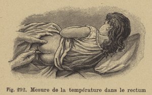 Rektale Temperaturmessung bei einem Kind