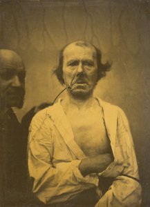 Ein entspanntes Gesicht (links); Ekel (rechts) von Guillaume Benjamin Amant Duchenne