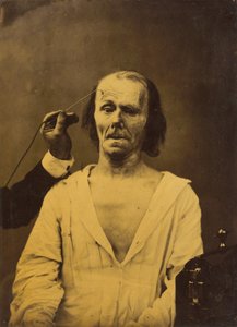 Ein entspanntes Gesicht (links); Tiefe Aufmerksamkeit (rechts) von Guillaume Benjamin Amant Duchenne