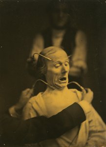 Ausdruck des Schreckens von Guillaume Benjamin Amant Duchenne