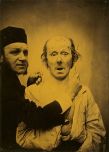 Überraschung