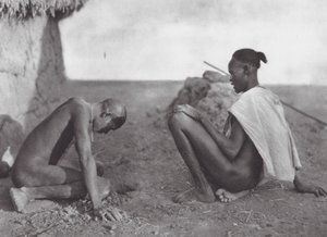Afrika: Medizinmann lässt einen Patienten bluten von Hugo Adolf Bernatzik