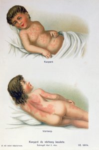 Masern und Scharlach, aus einem Familienmedizinbuch, ca. 1900 von Hungarian School