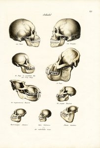 Menschliche Schädel, 1824 von Karl Joseph Brodtmann