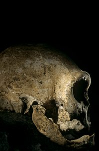 Homo erectus Schädel, zahnlos, Dmanisi, Georgien Homo Erectus Fundstätte