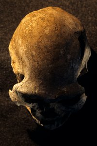 Homo erectus Schädel, zahnlos, Dmanisi, Georgien Homo Erectus Fundstätte