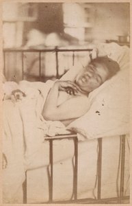 Hysterische Epilepsie, permanente Kontraktion, Tafel XXVIII aus 