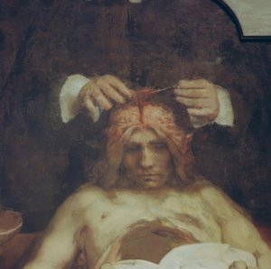 Die Anatomie des Dr. Johan Deijman