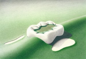 Einlage von Rene Boin