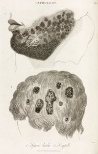 Dermatologie Hautkrankheiten