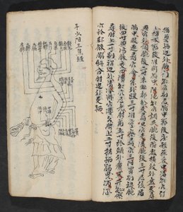 Akupunkturpunkte am Arm, Nacken und am Kopfansatz, aus Jing Guan Qi Zhi, 