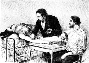 Dr. Roussell aus Genf führt eine direkte Bluttransfusion von einem Freiwilligen an eine Frau durch, 1882