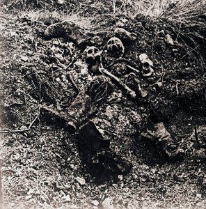 Menschliche Überreste, ca. 1914-1918