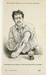 Eine Wunde mit einer antiseptischen Lösung behandeln, um 1890