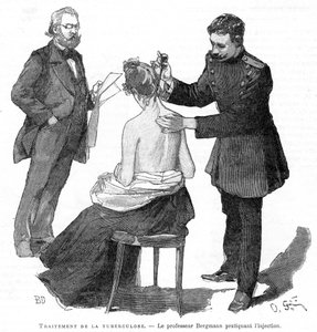 Professor Bergmann injiziert einem Tuberkulosepatienten, 1891
