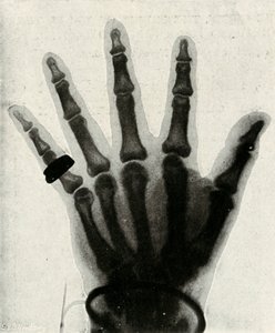 Röntgenaufnahme der Hand von H.R.H. Der Prinz von Wales von Unbekannt