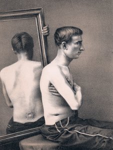 Genesung eines Verwundeten mit Bauchschuss, Amerikanischer Bürgerkrieg von Unbekannt