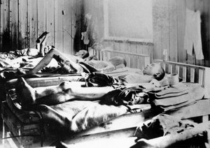 Überlebende der Explosion der Atombombe in Hiroshima, Japan, 1945