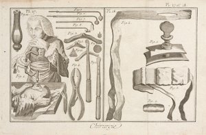 Trepanation