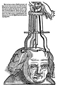 Trepanation, 1593 von Unbekannt