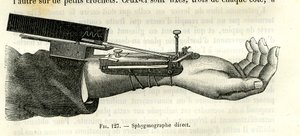 Direkter Sphygmograph von Unbekannter Künstler