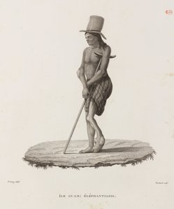 Krankheiten, Tropische Krankheiten Mann mit Elephantiasis, Guam von Unbekannt